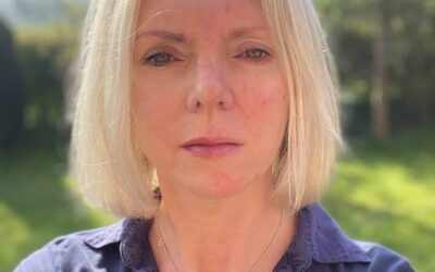 My Rosacea Skincare Routine – for rosacea awareness month